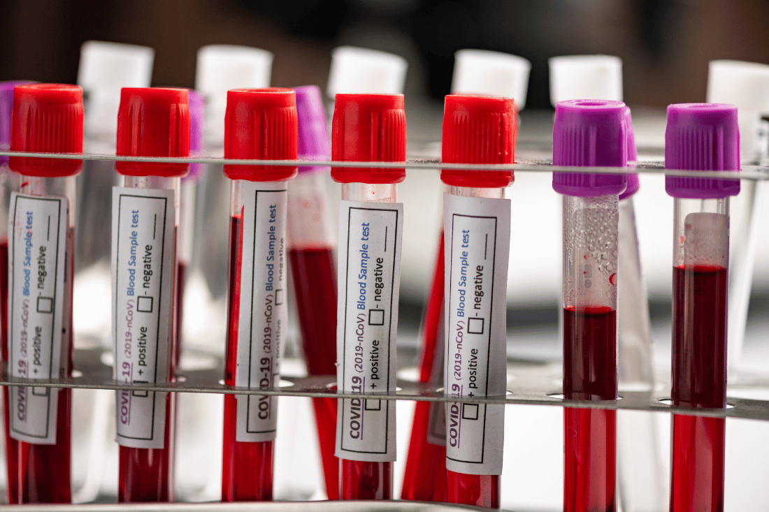 toxicology testing los angeles